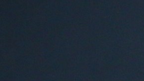 Chrissy Teigen revela un "arreglito" que se hizo.