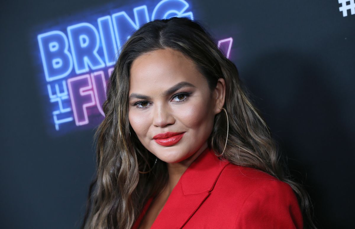 Chrissy Teigen had hair removed from the back of her head and transplanted into her eyebrows
