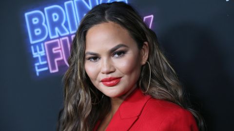 Chrissy Teigen revela un "arreglito" que se hizo.