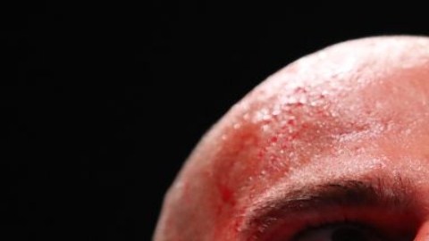 Kiko Martínez, boxeador español.