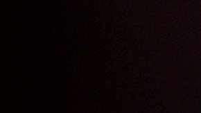 Hombre pierde piernas y parte de la cara por bacteria que le trasmitió su perro al lamerlo