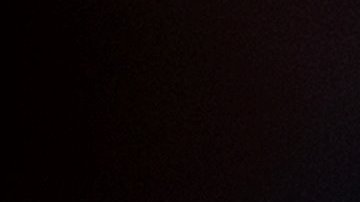 Hombre pierde piernas y parte de la cara por bacteria que le trasmitió su perro al lamerlo