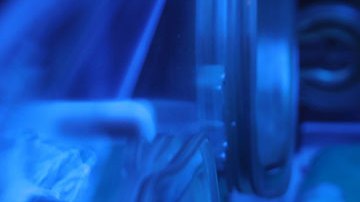 La bacteria "estreptococo B" está causando la muerte de miles de bebés en el mundo, alerta la OMS.