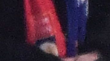 Dimitry Payet recibió un botellazo en partido del Marsella contra Lyon.