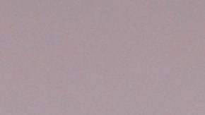 Fauci bajo la lupa, después de que el Instituto Nacional de Salud fue acusado de gastar $1.2 millones de dólares en experimentos con perros Beagle