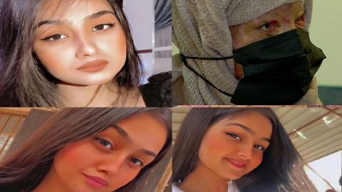 Maryam al-Rukabi, jovencita de 16 años es desfigurada con ácido por sujeto por negarse a casar con él