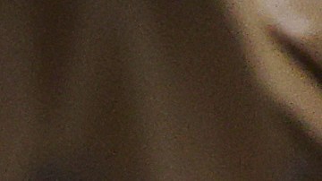 Mujer gana demanda millonaria a una estética en Tampa