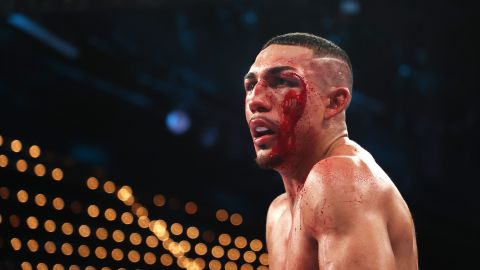 Teofimo Lopez perdió contra George Kambosos.