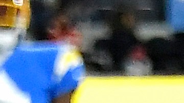 Donald Parham, de los Chargers, tras el golpe en la cabeza que le causó la lesión.
