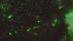 Pechuga de pollo es una fuente de proteína para mejorar la salud corporal