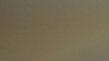 Trasplantan con éxito dos riñones de cerdo modificado genéticamente a receptores humanos