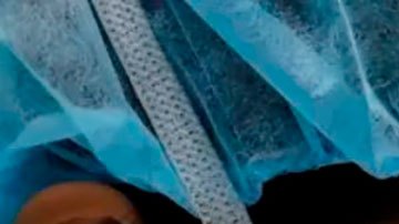 ¿Por qué las mujeres tienen más probabilidades de morir cuando son operadas por cirujanos hombres?