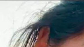 "Sara tenía 30 perforaciones en varios órganos, lesiones más propias de una reyerta con armas": la muerte en España de una mujer tras una operación de cirugía estética