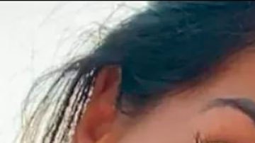 "Sara tenía 30 perforaciones en varios órganos, lesiones más propias de una reyerta con armas": la muerte en España de una mujer tras una operación de cirugía estética