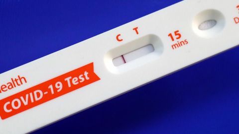 Recomiendan a los padres de familia hacerles el examen de covid antes del regreso a clases. (Cortesía)