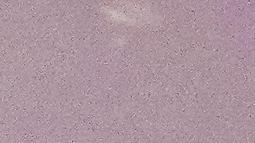 Disputa laboral termina con tiroteo en el Aeropuerto de Miami, el cual deja dos trabajadores heridos