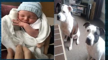 Bebé pasó una semana en el hospital con graves lesiones por ataque de un perro.