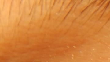 Los lunares del cuerpo tienen un significado según donde se encuentren ubicados.