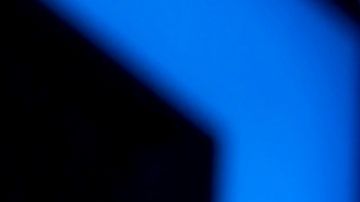 Alicia Machado confirma que se hará una nueva cirugía estética