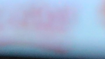 Álvaro Fidalgo  se llevó un duro codazo que terminó rompiéndole los labios.