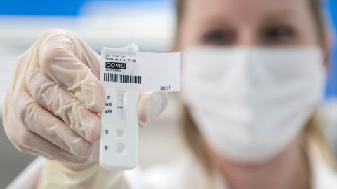 Hombre en Turquía lleva 14 meses aislado al dar positivo en 78 pruebas consecutivas de COVID