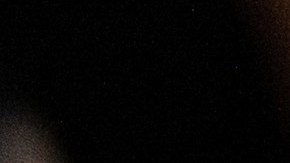 Niño de 10 años en Wisconsin muere por rara afección inflamatoria provocada por el COVID