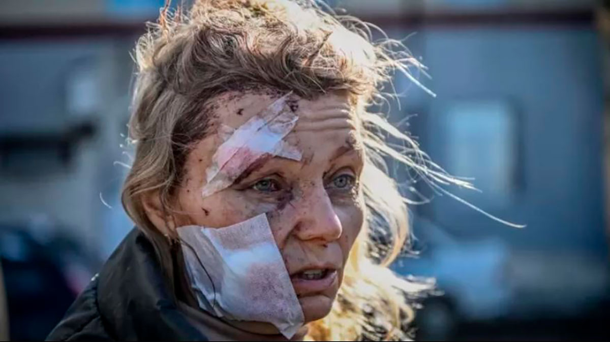 Una mujer que resultó herida por los bombardeos rusos se convirtió en objeto de teorías de conspiración y afirmaciones falsas en internet.