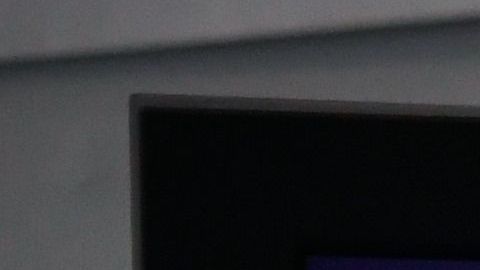 Implante cerebral permite a un hombre en estado de parálisis total volver a comunicarse