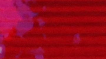 El luchador Scott Hall sufrió tres infartos.