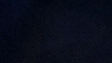 El peleador necesitó 12 puntos de sutura.