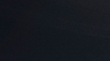 In this photograph taken on December 18, 2017, seven year old French child Anais, undergoes heart surgery to cure a congenital Atrial septal defect, at an operating theatre at The Marie Lannelongue Hospital at Le Plessis-Robinson south of Paris. The intervention is being undertaken by a Pediatric Cardiothoracic Surgery team of the hospital in Le Plessis-Robinson which specialises in thoracic and cardiovascular surgeries, and congenital heart diseases. / AFP PHOTO / THOMAS SAMSON (Photo credit should read THOMAS SAMSON/AFP via Getty Images)