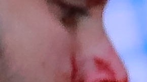 Sangrienta pelea en el partido Atlas vs Querétaro.