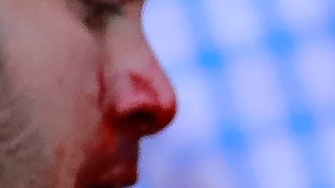 Sangrienta pelea en el partido Atlas vs Querétaro.