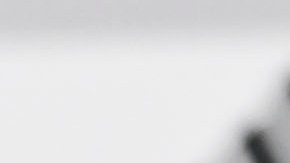 Gerardo 'Tata' Martino explica a periodistas la seriedad de su lesión en el ojo derecho.