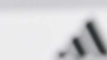 Gerardo 'Tata' Martino explica a periodistas la seriedad de su lesión en el ojo derecho.