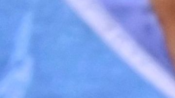 Mujer que los médicos pensaron que tenía una infección urinaria en realidad tenía un vaso de vidrio atorado en la vejiga durante 4 años