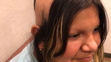 Anna Paula Preciado, una niña de 11 años en la lucha contra la alopecia. (Cortesía Ana Antonia Losoya)