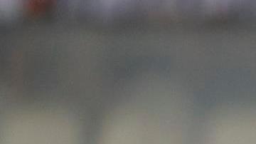 El defensa Robert Rojas sufrió una fractura de tibia y peroné.