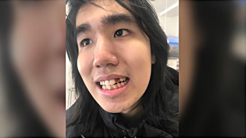 Dallas Ly fue arrestado y se encuentra encarcelado.