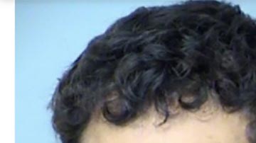 La pareja dijo que no sabía cómo se había ocasionado esos golpes.