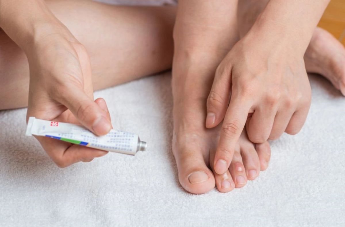 Cómo eliminar las manchas de las uñas de los pies - La Opinión