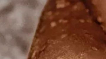 Viruela del mono: qué es esta enfermedad detectada en Europa y Norteamérica y qué riesgos entraña para la salud
