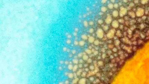 Viruela del mono: lo que se sabe del inusual brote detectado en varias regiones y por qué no será "como otra pandemia de covid"
