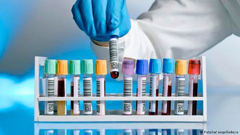 Argentina detecta primer caso de hepatitis infantil desconocida