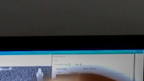 ONU advierte sobre ola de racismo y homofobia ante propagación de la viruela del mono