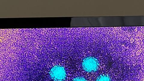 OMS registra cerca de 230 casos de misteriosa hepatitis infantil