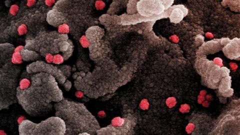 Nuevo estudio revela que el cambio climático podría desencadenar la próxima pandemia