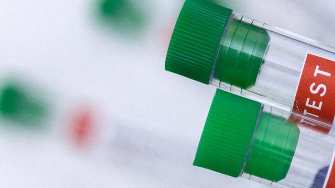 OMS descarta por ahora una pandemia por viruela del mono