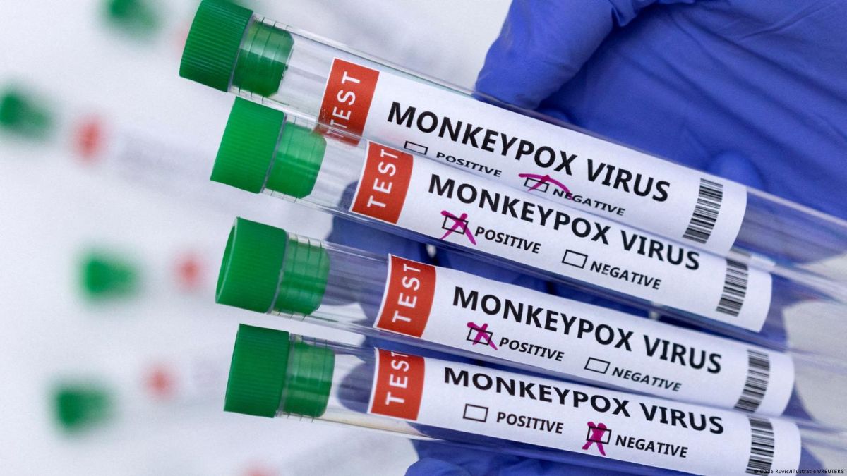 OMS descarta por ahora una pandemia por viruela del mono
