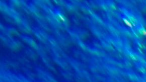 Hombre salva milagrosamente a niño con autismo que se ahogaba en una piscina